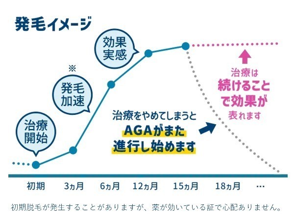 レーザースキンクリニック 金沢駅前院（AGAスキンクリニック）こだわり8