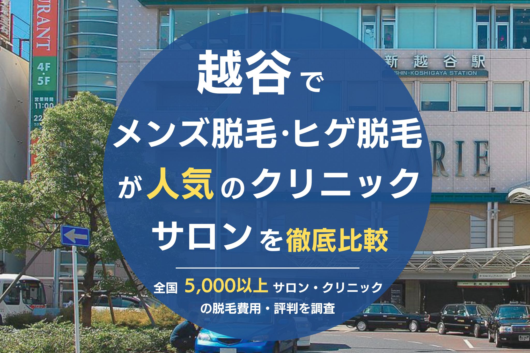 越谷でメンズ脱毛・ヒゲ脱毛がおすすめの医療脱毛クリニック・脱毛サロンを徹底比較