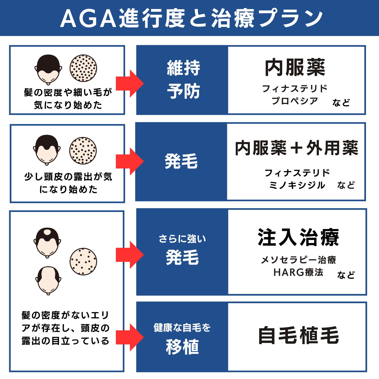 【東京都】AGA症状の進行度とAGA治療プラン