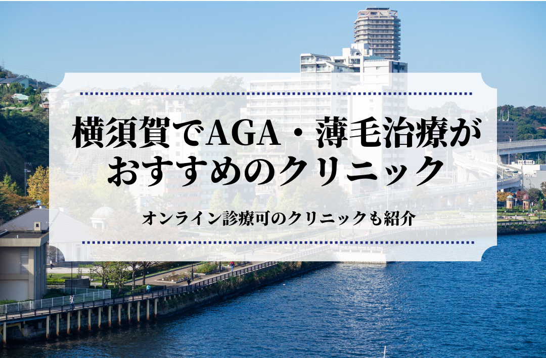 横須賀でAGA・薄毛治療はおすすめのクリニック