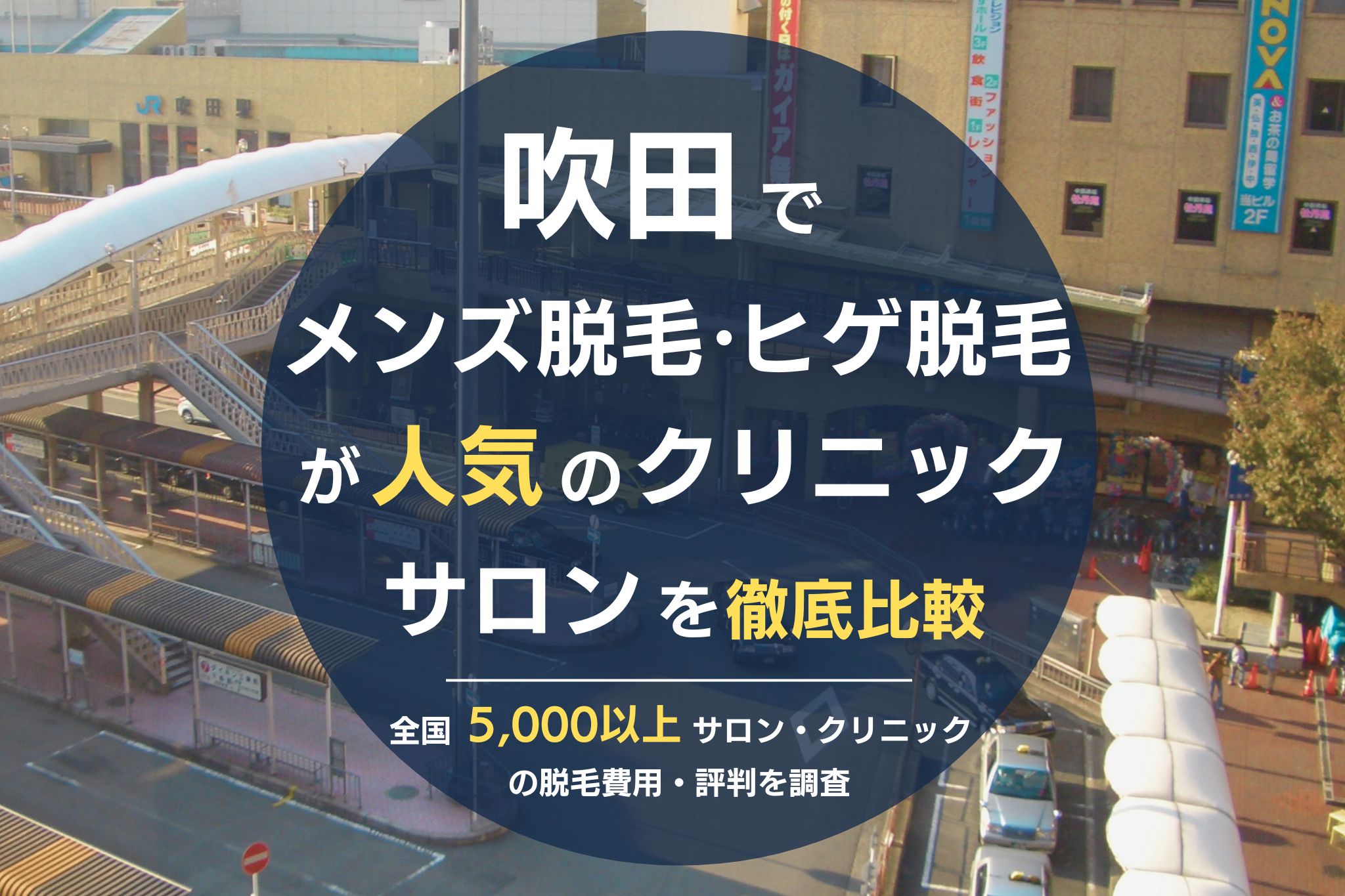 吹田でメンズ脱毛・ヒゲ脱毛がおすすめの医療脱毛クリニック・脱毛サロンを徹底比較