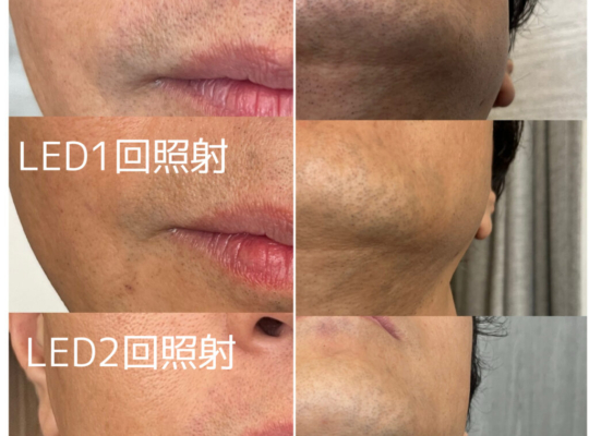 メンズグルーミングラボMEGURU7