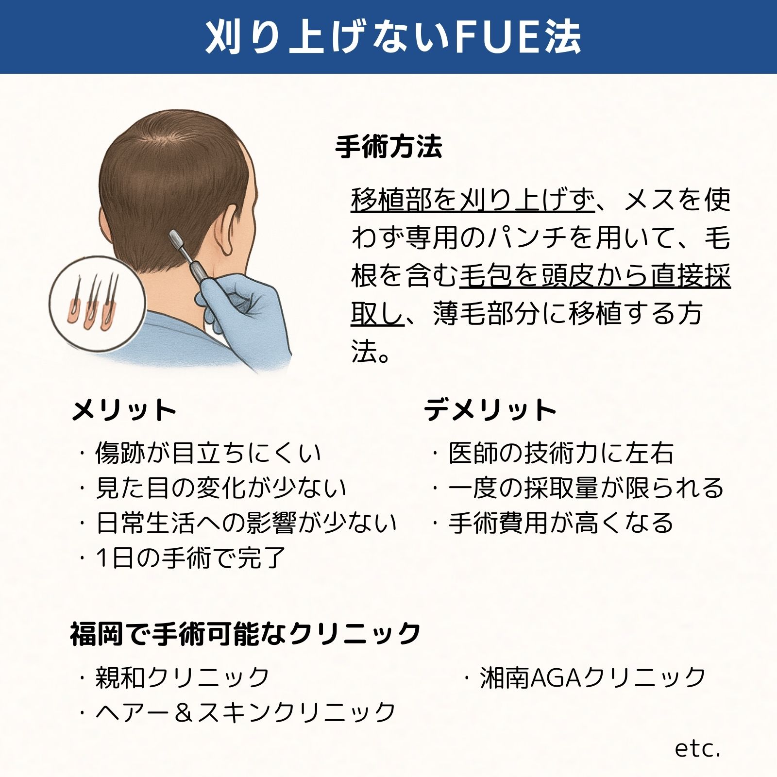 福岡刈り上げないFUE法