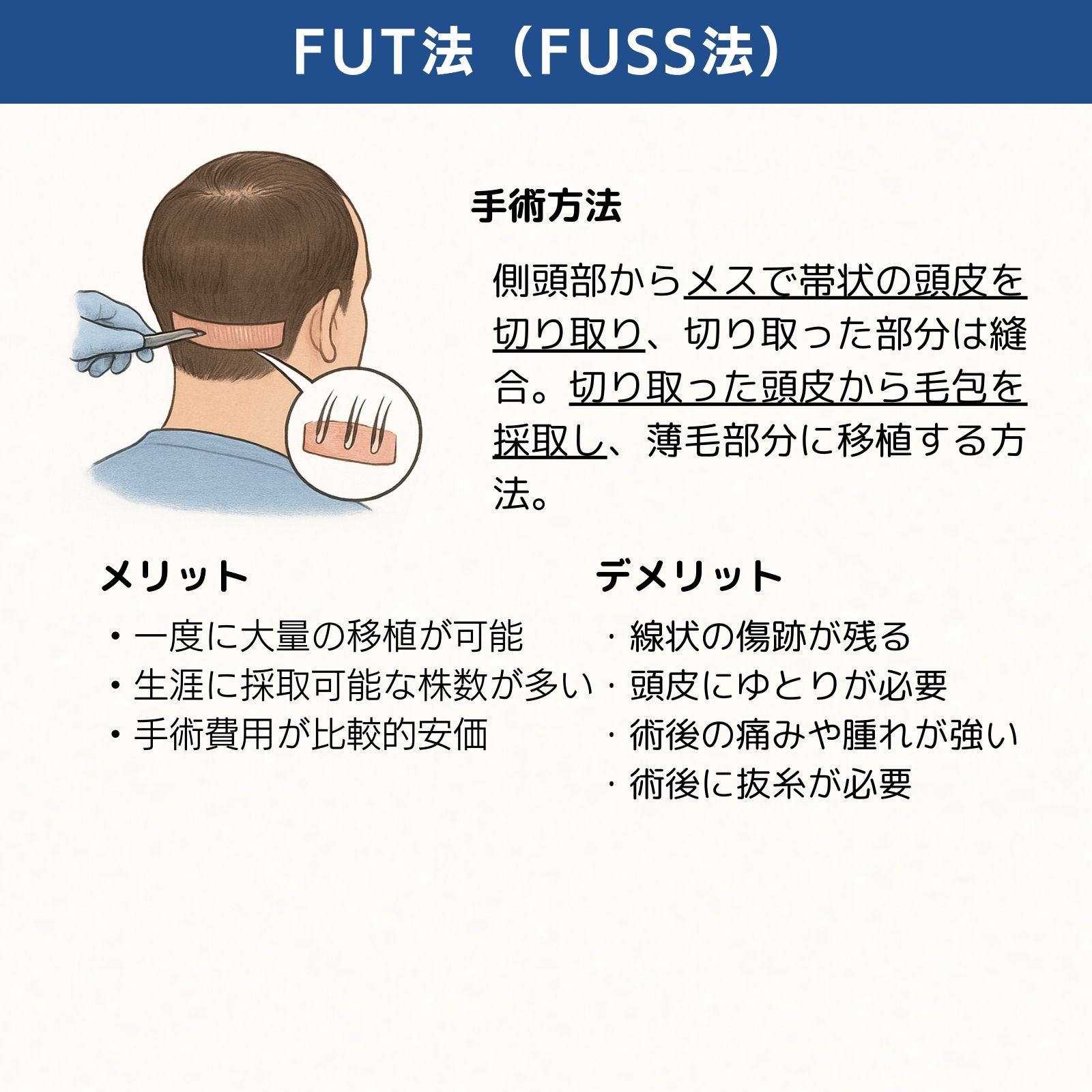 福岡FUT法