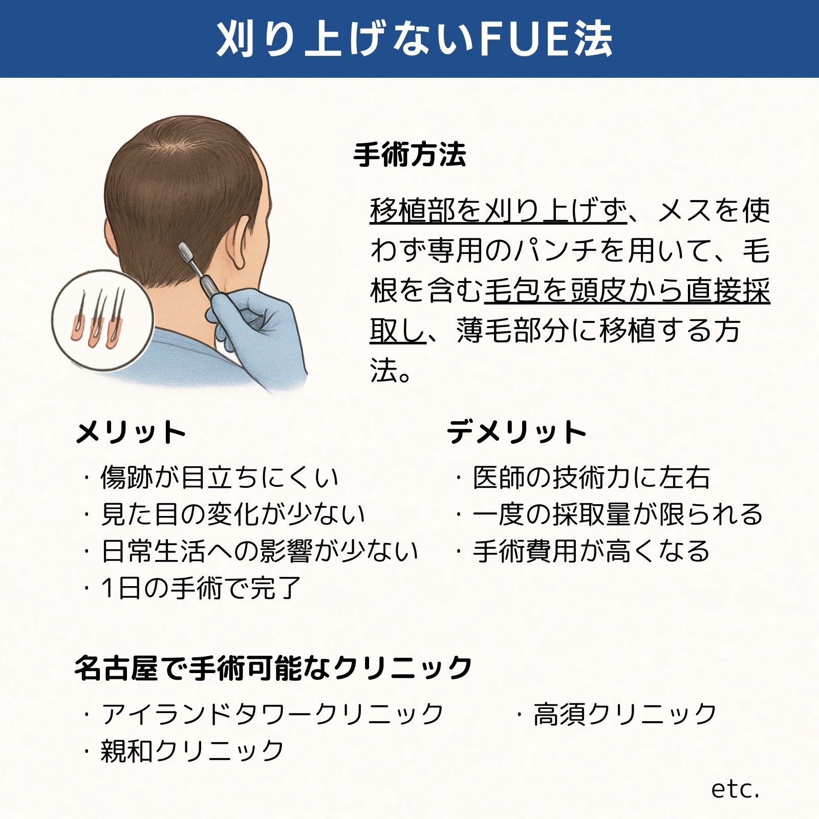 名古屋刈り上げないFUE法