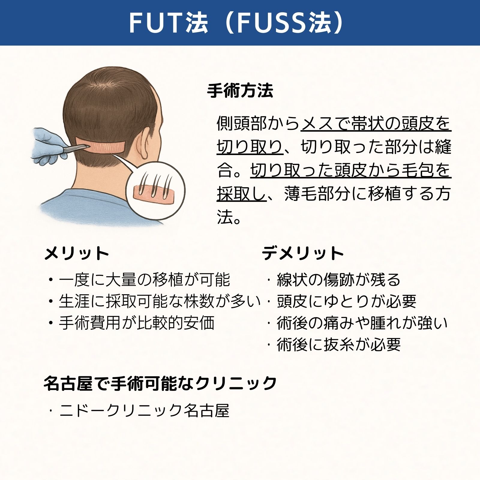 名古屋FUT法