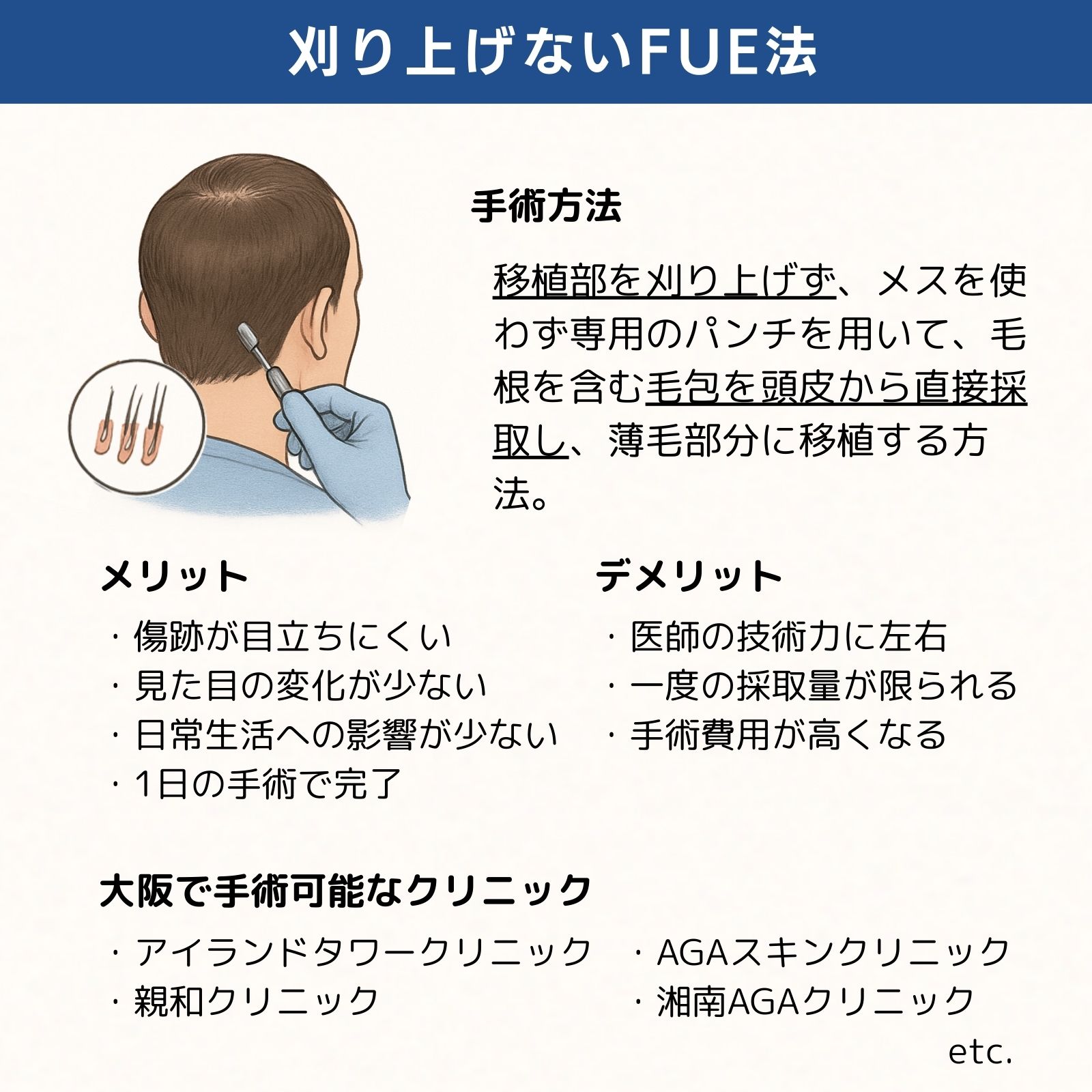 刈り上げないFUE法