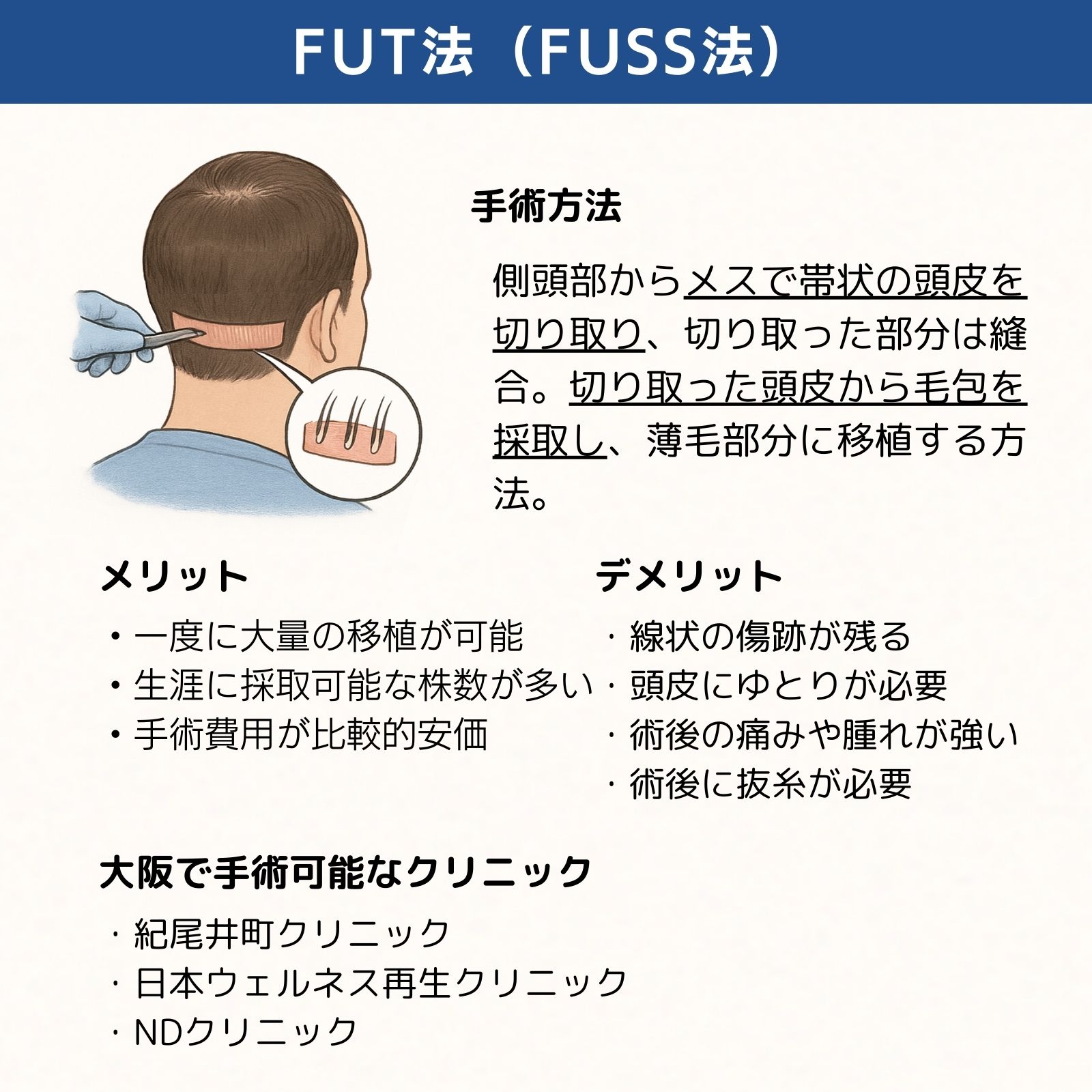 osaka_fut_fuss