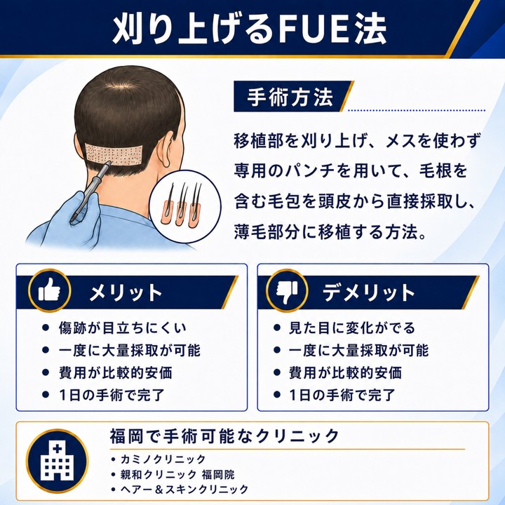 福岡で刈り上げるFUE法が可能なクリニックを紹介！刈り上げるFUE法のメリットデメリットを解説