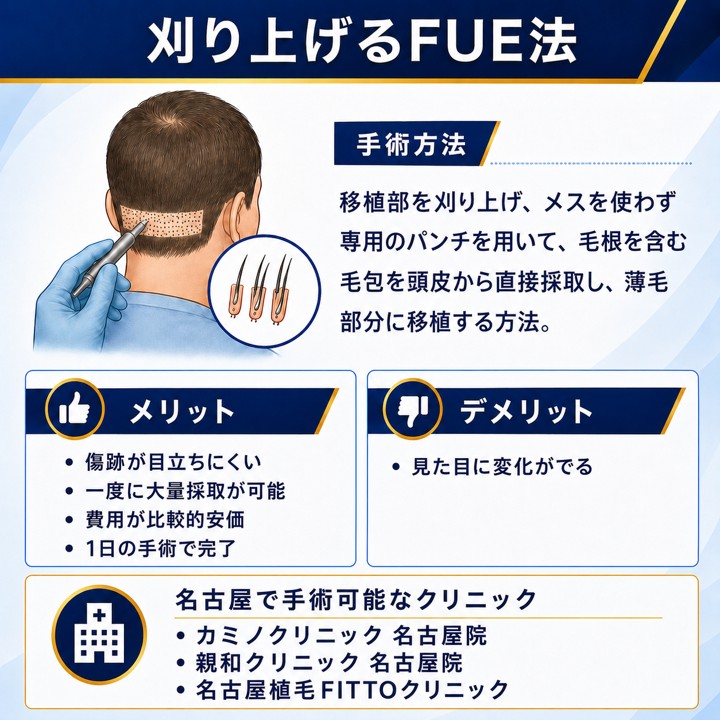 名古屋で刈り上げるFUE法の自毛植毛が可能なクリニック
刈り上げるFUE法の手術方法とメリット・デメリット
