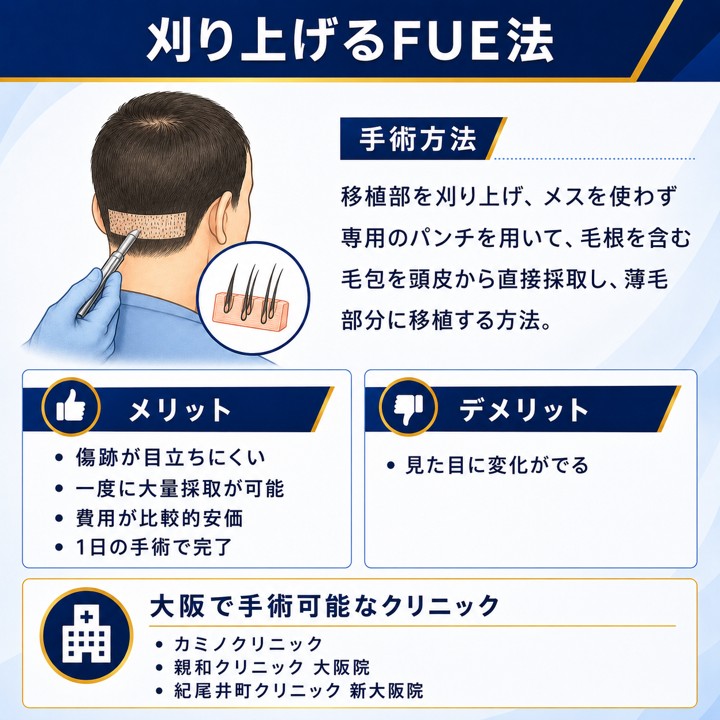 大阪で刈り上げるFUE法の自毛植毛が可能なクリニック
刈り上げるFUE法の手術方法とメリット・デメリット