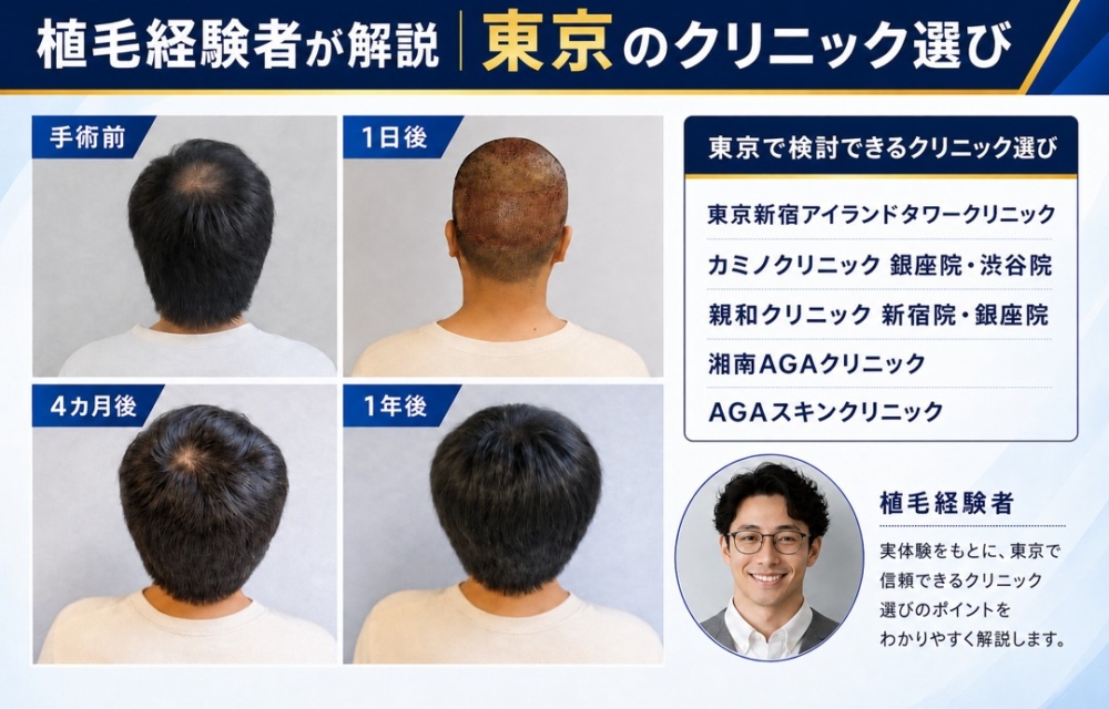 植毛経験者が解説東京のクリニック選び